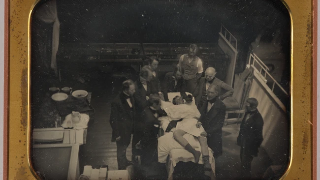Early daguerreotype of surgeons gathered around a patient on an operating table in a tiered surgical theater.