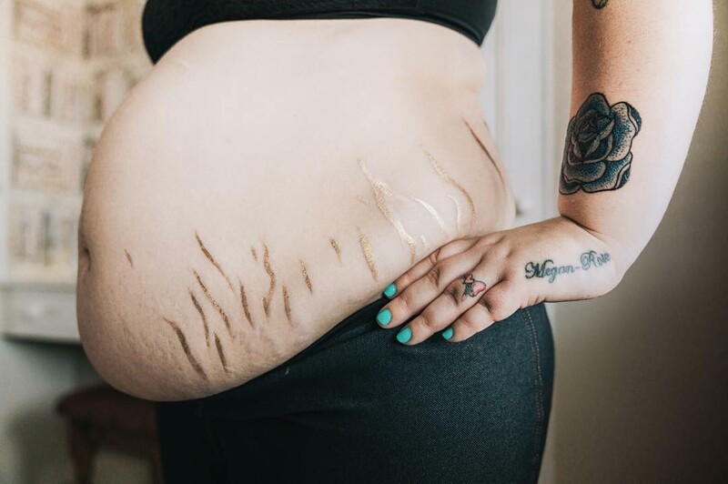 Postpartum Mother showing her belly.