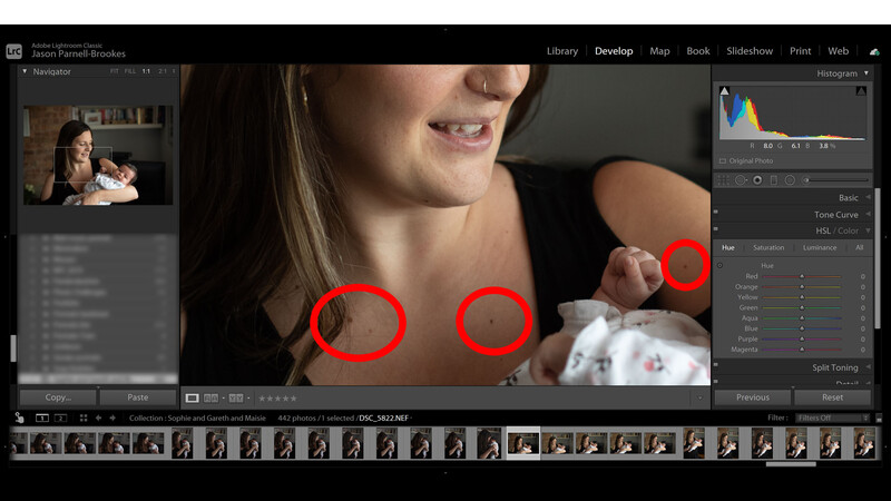 Not removing moles in lightroom