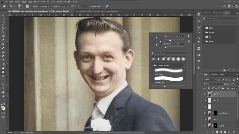 Burn tool used on face
