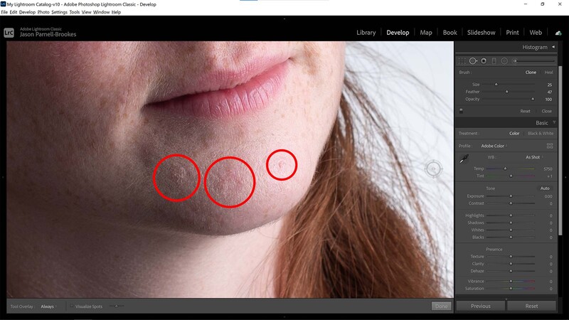 Blemishes on face