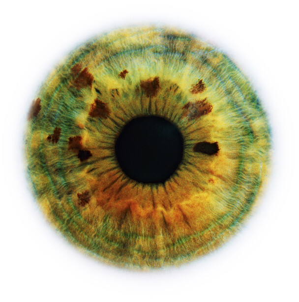 Close-up macro photograph of a human iris with golden-yellow and green coloring, showing radiating fibers and a black pupil.
