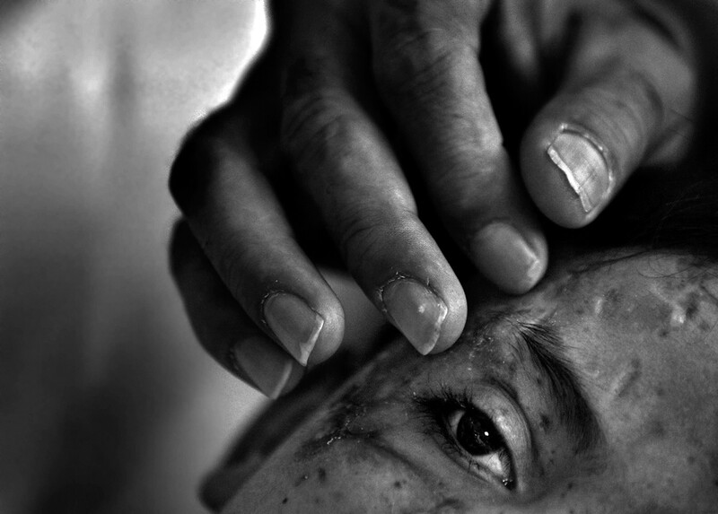 Close-up black and white portrait of a person's face with hands gently framing the side of the head.