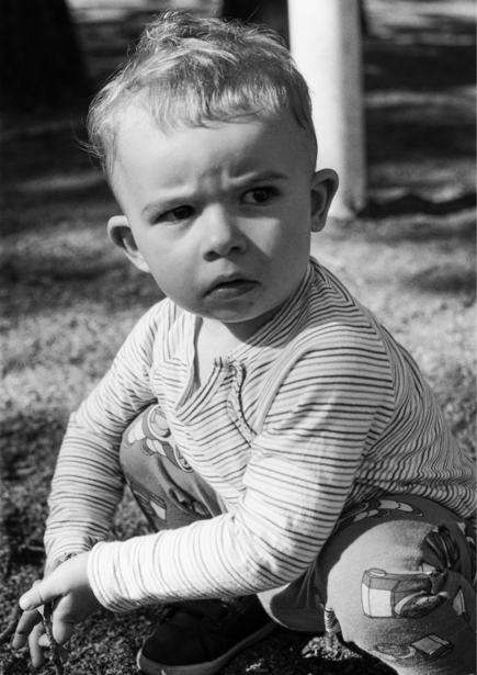 Young child sitting outdoors with a bandaged arm, looking directly at camera in black and white portrait.
