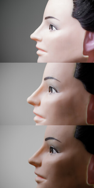 Three profile views of a face showing subtle differences in facial structure and proportion.