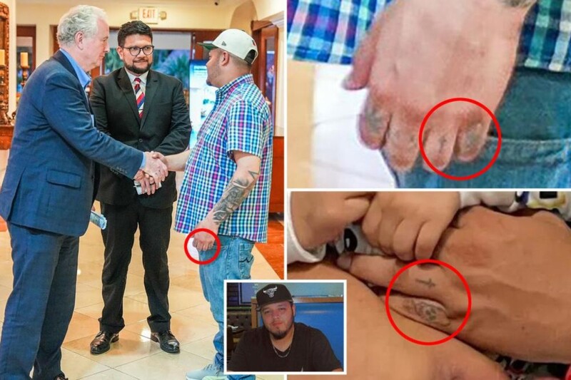 Composite image showing hand details with red circles highlighting specific marks or features on multiple people's hands.