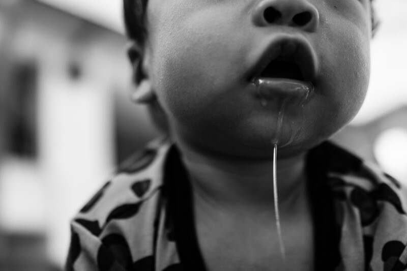 Child's face in black and white, mouth open with saliva dripping, shot against blurred background.