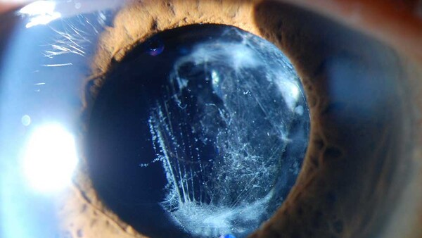 A Very Rare Genre: Medical Photography