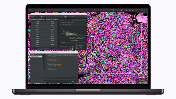 Screenshot of image processing software displaying colorful data visualization and code windows on laptop screen.