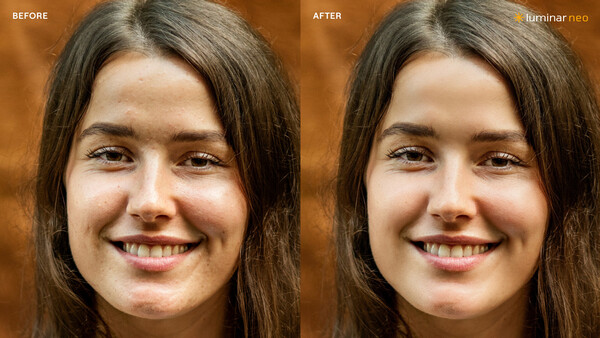 Before and after skin retouching comparison showing reduced blemishes and smoother complexion.