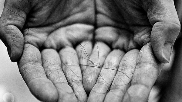 Powerful Photos Document Daily Life Fighting Cancer