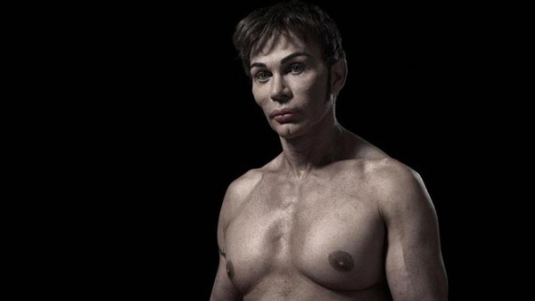 Portraits Of Extreme Plastic Surgery (NSFW)