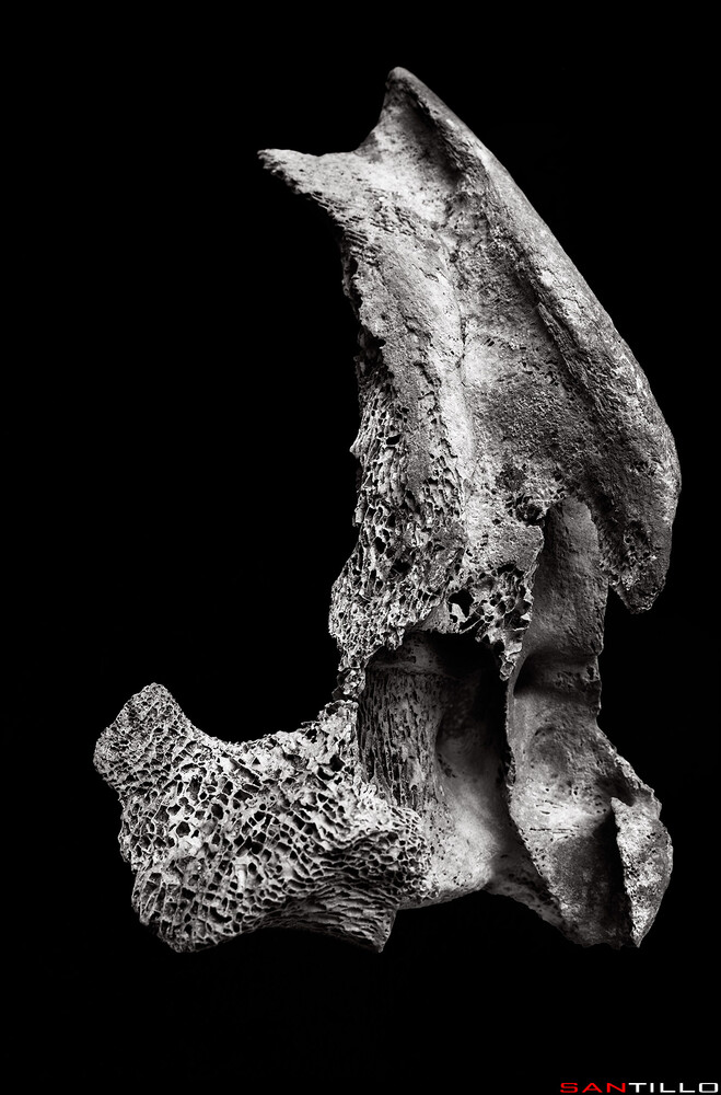 High-contrast black and white macro photograph of insect anatomy showing detailed leg and body structure