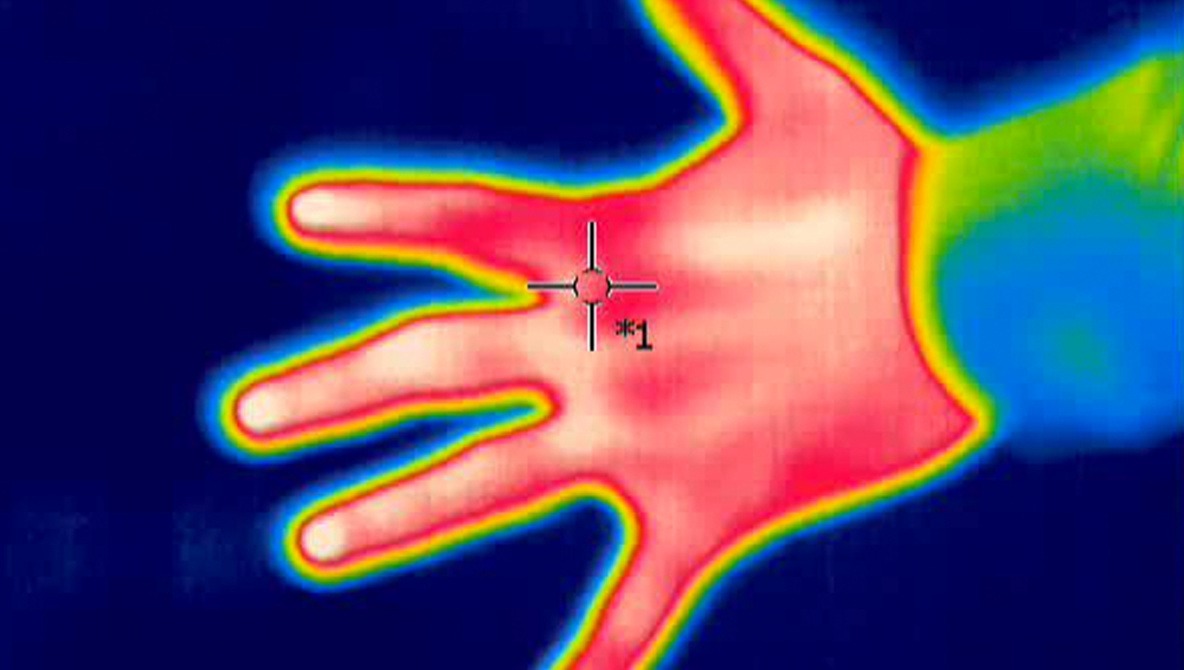 Thermal Camera at Tourist Attraction Spots Woman's Undiagnosed Breast Cancer