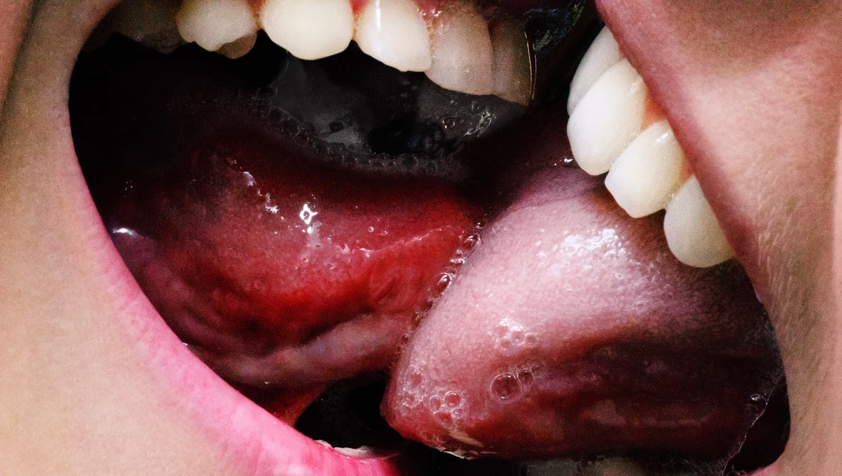 Close-up macro photograph of open mouth showing tongue, teeth, and oral cavity with red and pink tones.