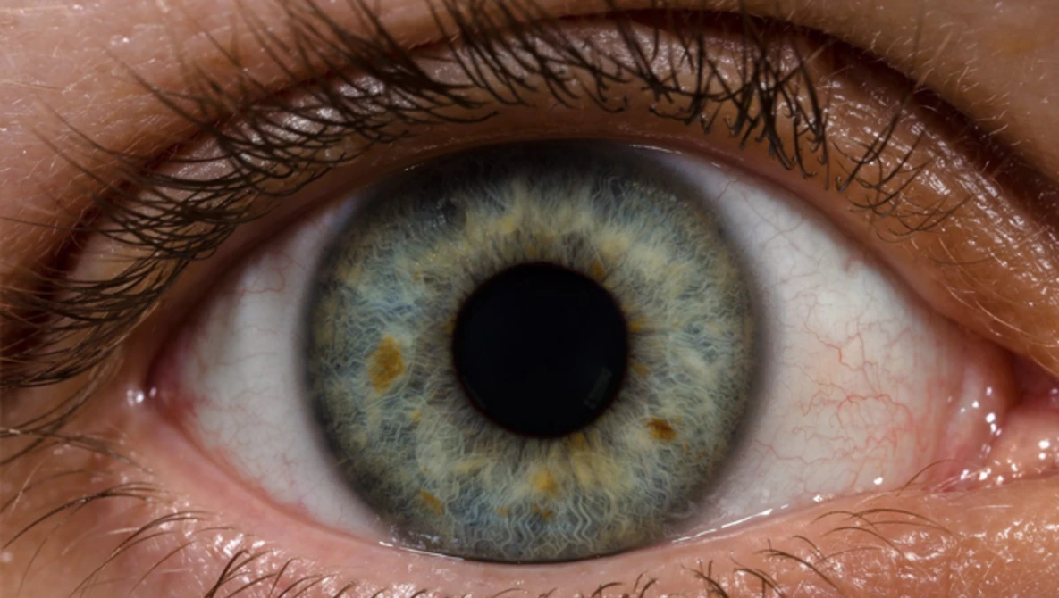 Watch What Is The Resolution Of The Eye? on YouTube.