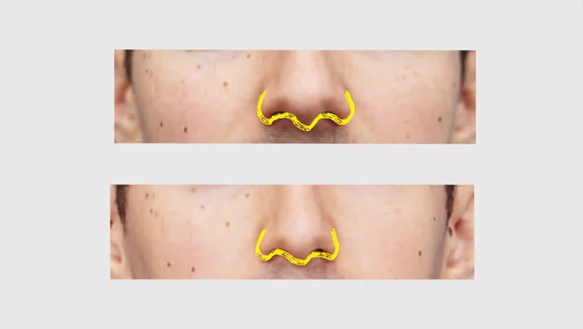 Watch Why selfies can make your nose look bigger on YouTube.