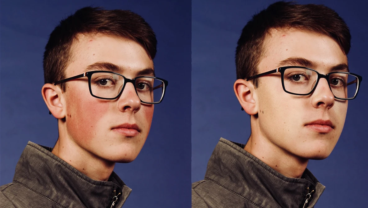 Watch 1-Minute Photoshop - Remove Red Patches from Skin on YouTube.