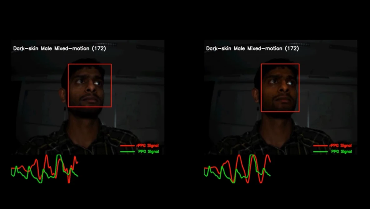 Watch Motion Robust Remote-PPG (Camera-based heart-rate monitoring) on YouTube.