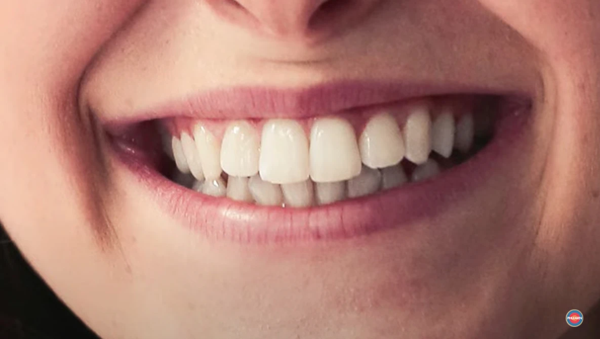 Watch How to Whiten Teeth in Photoshop on YouTube.