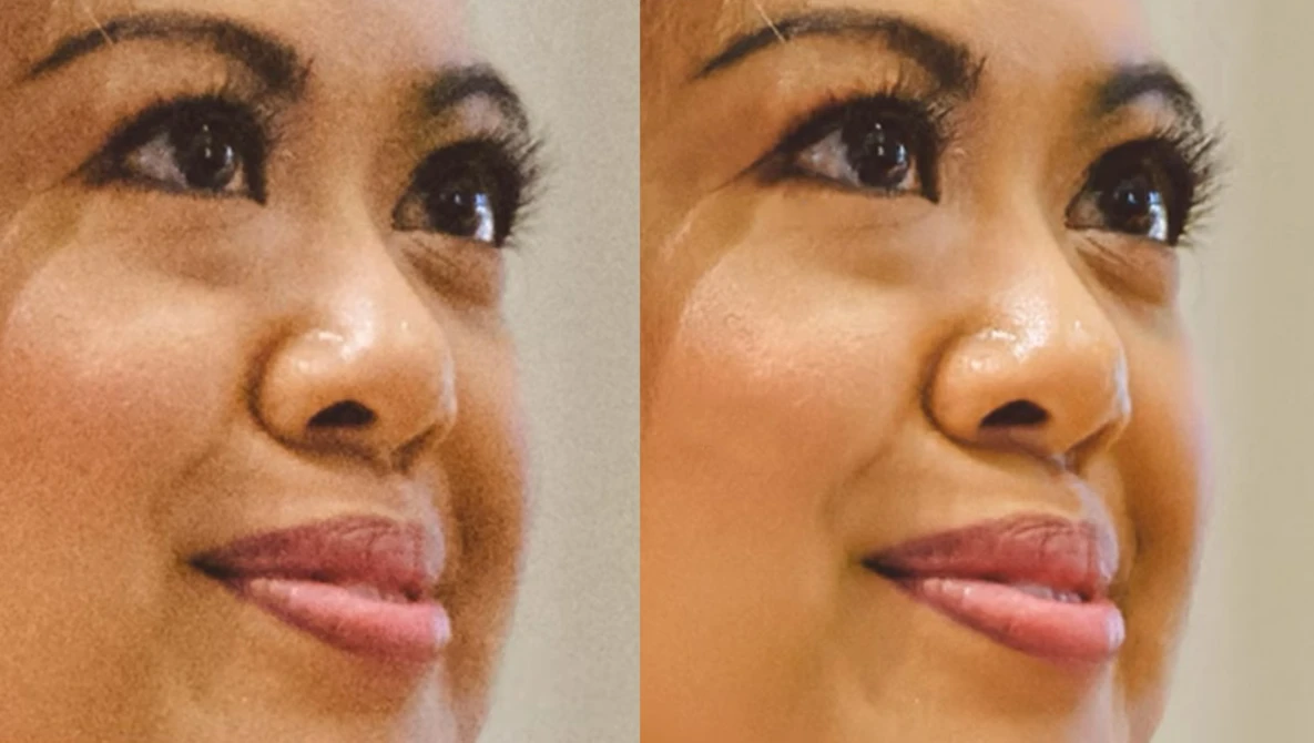 Before and after comparison of skin retouching showing reduced under-eye shadows and smoother complexion texture.