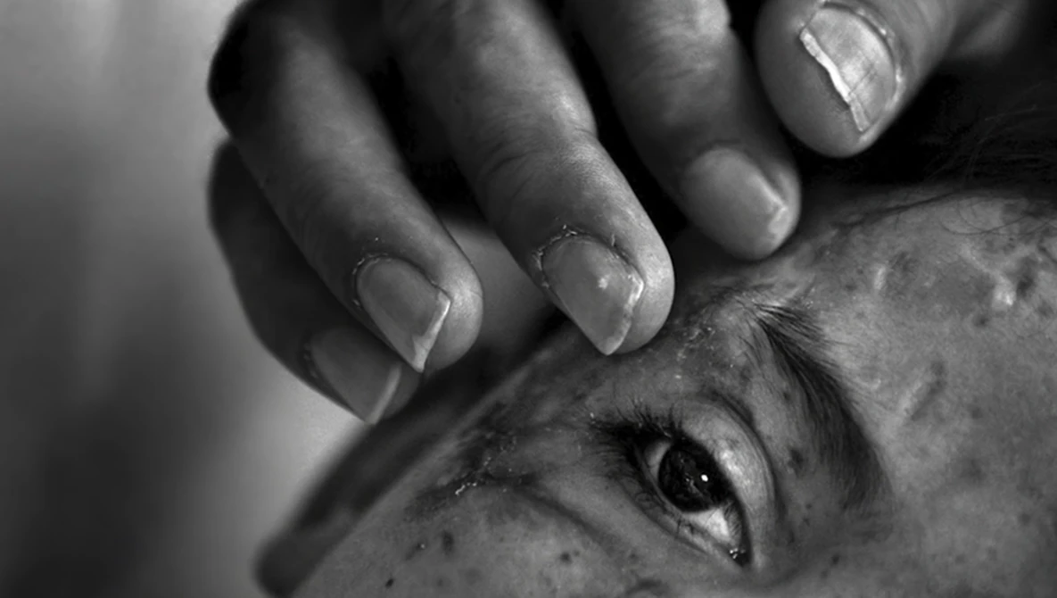 Close-up black and white portrait of a person's face with a hand touching their cheek and eye area.
