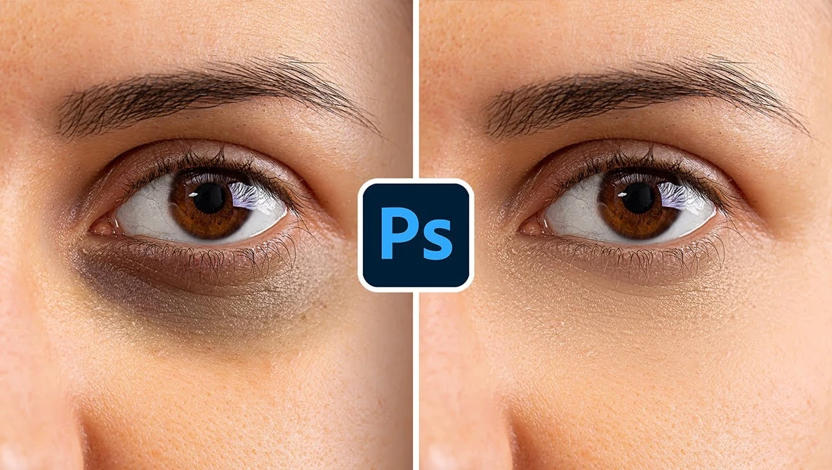 Before-and-after comparison showing dark under-eye circles reduced through digital retouching in Photoshop.