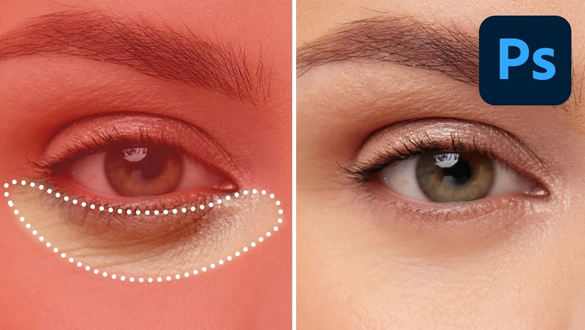 Before and after comparison of under-eye retouching in Photoshop, showing redness and swelling removal.
