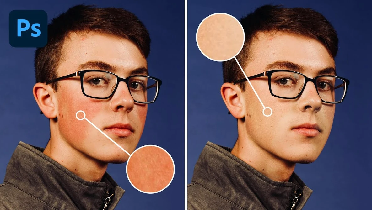 Side-by-side comparison showing skin retouching before and after in Photoshop.