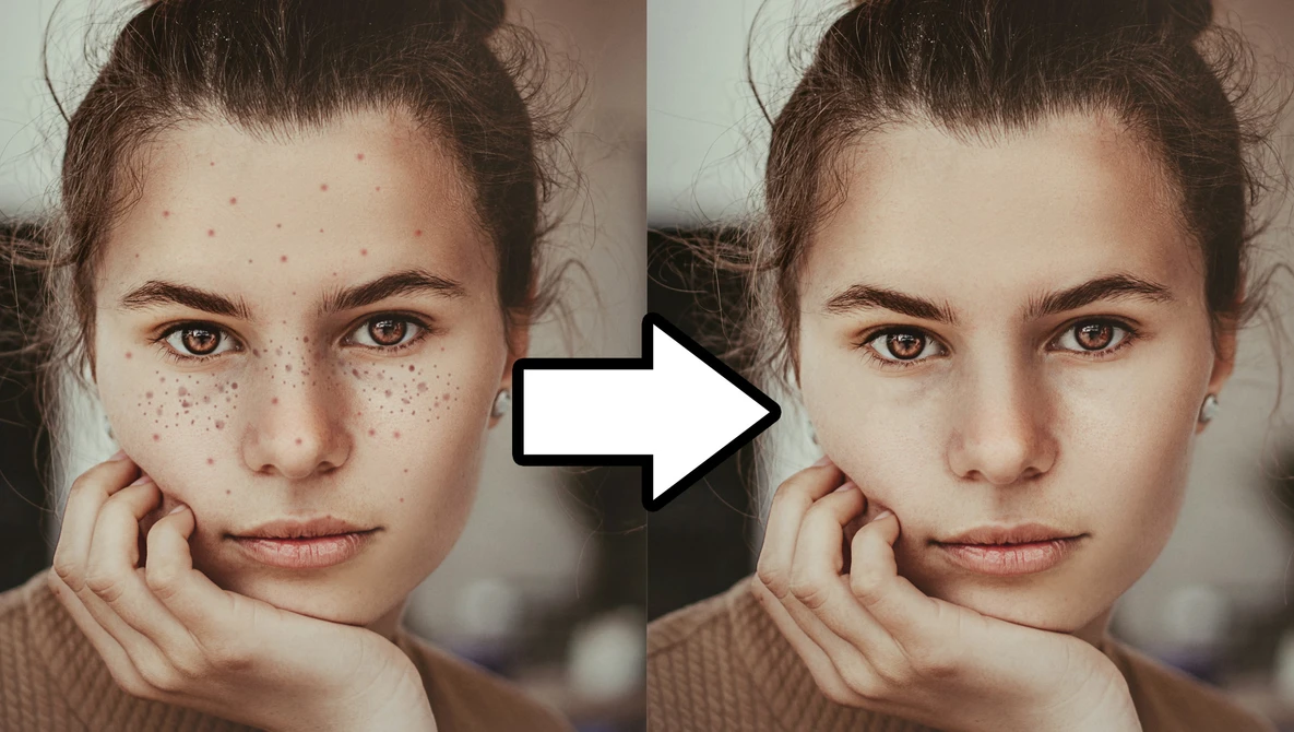 Before and after portrait comparison showing skin retouching effects on a young woman with freckles.