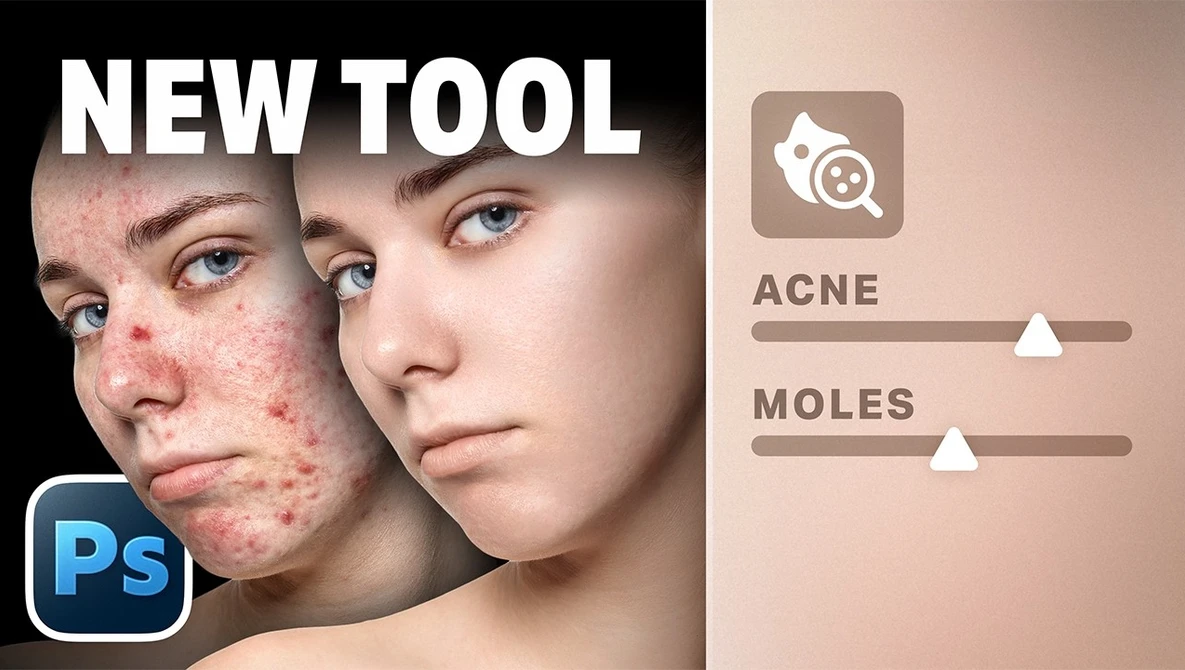 Screenshot comparing before-and-after skin retouching with adjustment sliders for acne and moles in Photoshop