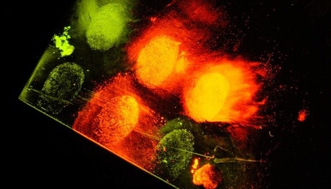 The Remarkable World of a Forensic Imaging Specialist
