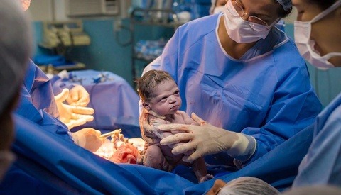 Photographer Captures Moment Newborn Baby Gives Doctors a 'Death Stare' as They Try to Make Her Cry