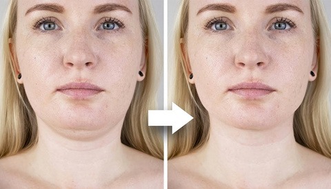 How to Retouch a Double Chin Using Photoshop