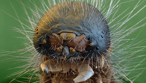 Outstanding Examples of Electron Microscope Photography