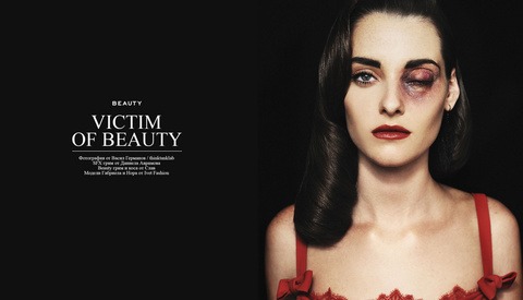 Major Controversy Over "Victims Of Beauty" Photo Series
