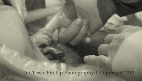 Photo of Baby Grabbing Doctor's Finger During C-Section Goes Viral