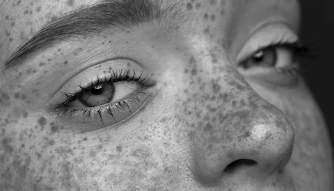 An Easy Way to Enhance Freckles