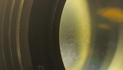 Fighting Gear Fungus? Meet Your New Best Friend