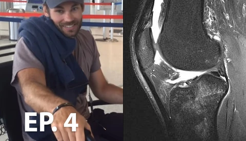 What Happened When I Broke My Leg While Filming Our Last Project