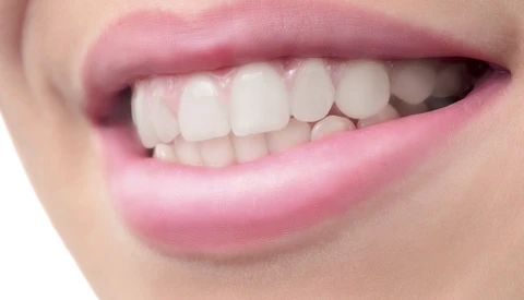 How to Remove Braces Using Photoshop