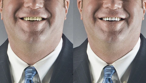 Create an Easy Photoshop Action for Teeth Whitening 