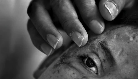 Close-up black and white portrait of a person's face with a hand touching their cheek and eye area.