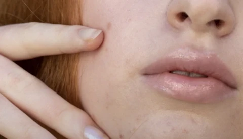 Close-up portrait showing smooth skin texture, soft natural lighting on face and neck.