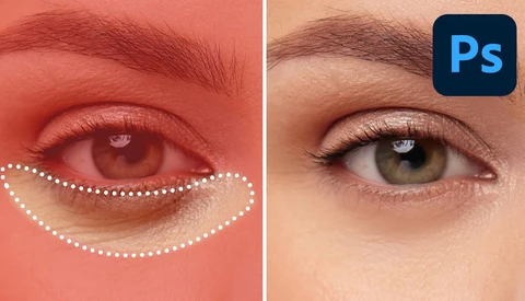 Before and after comparison of under-eye retouching in Photoshop, showing redness and swelling removal.