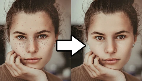Before and after portrait comparison showing skin retouching effects on a young woman with freckles.