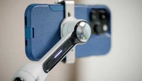 Macro lens attachment mounted on smartphone with blue case, showing optical magnification element close-up.