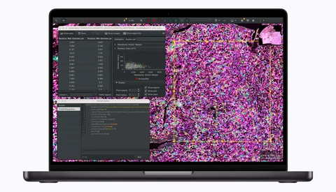 Screenshot of image processing software displaying colorful data visualization and code windows on laptop screen.