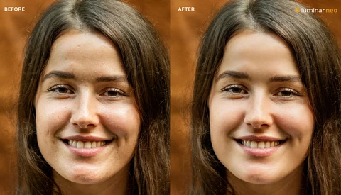 Before and after skin retouching comparison showing reduced blemishes and smoother complexion.
