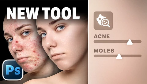 Screenshot comparing before-and-after skin retouching with adjustment sliders for acne and moles in Photoshop